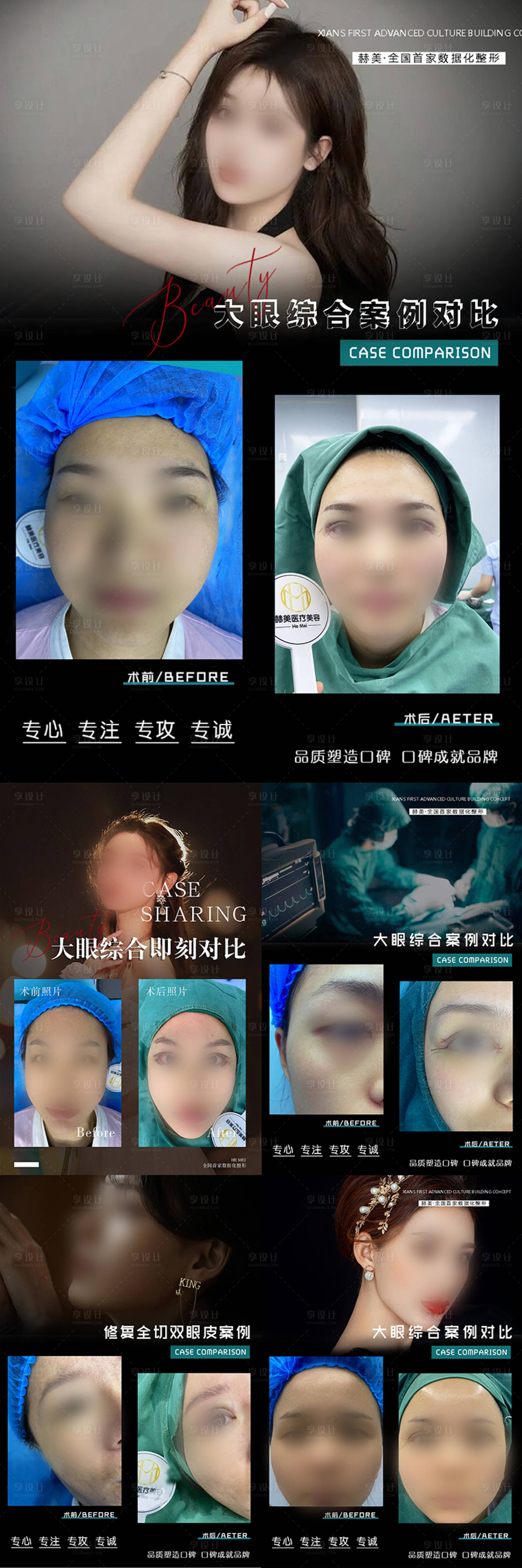 源文件下载【享设计】搜索编号：68310027294527044【医美案例对比宣传长图海报】