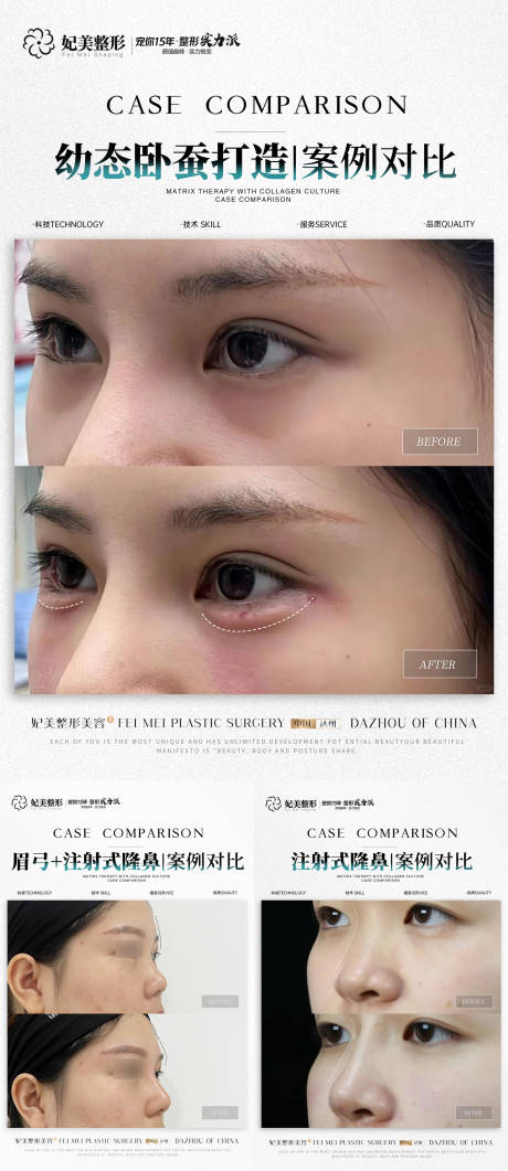 源文件下載【醫(yī)美美業(yè)案例對(duì)比】編號(hào)：92740027327644270