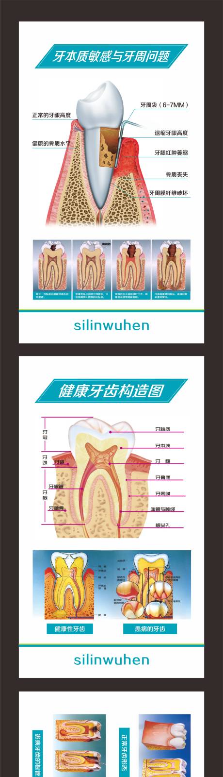 源文件下载【牙齿构造图系列海报】编号：87050027334792554