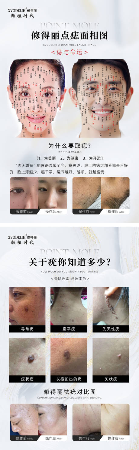 源文件下載【享設計】搜索編號：44040027290897166【醫美美容點痣面相圖祛疣介紹海報】