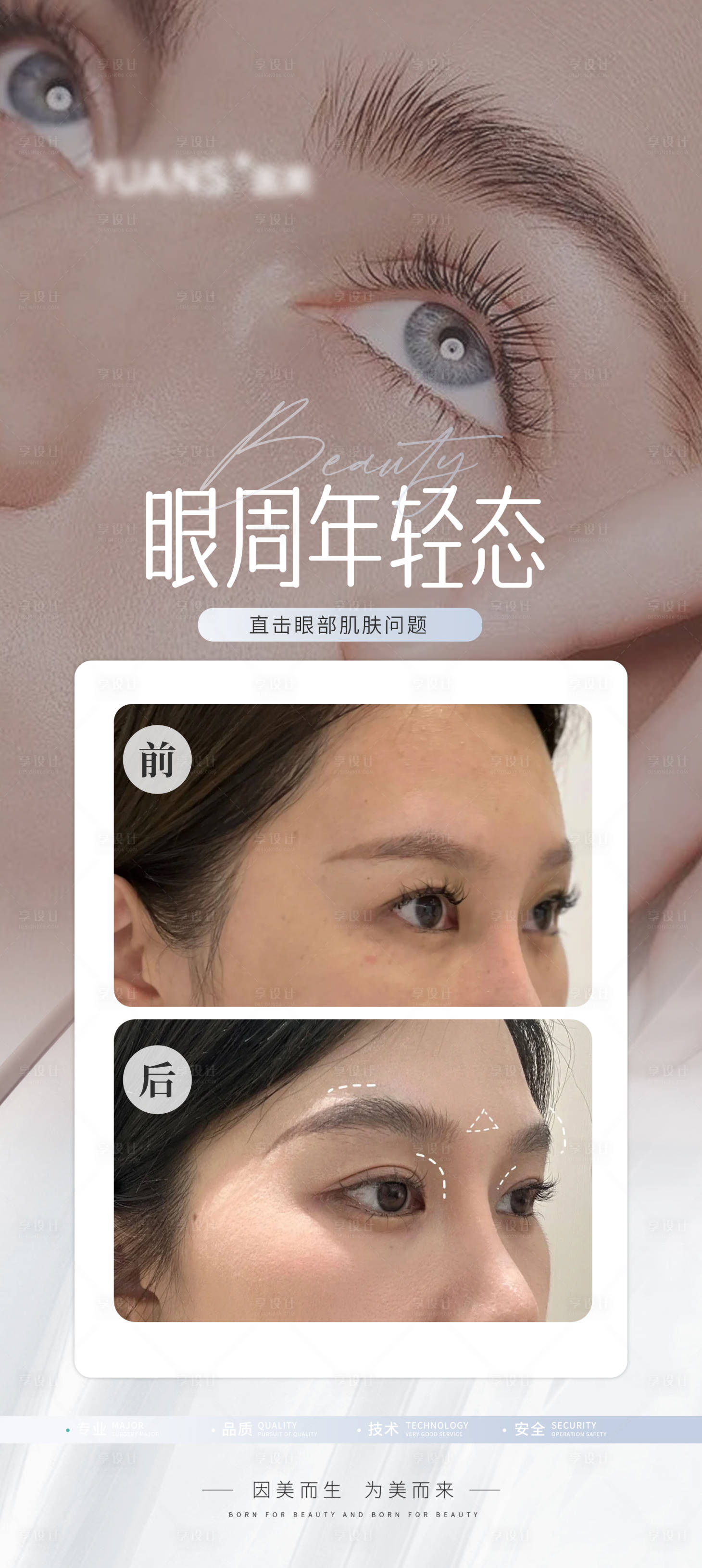 源文件下载【享设计】搜索编号：70900027381188775【医美眼周眼睛案例】