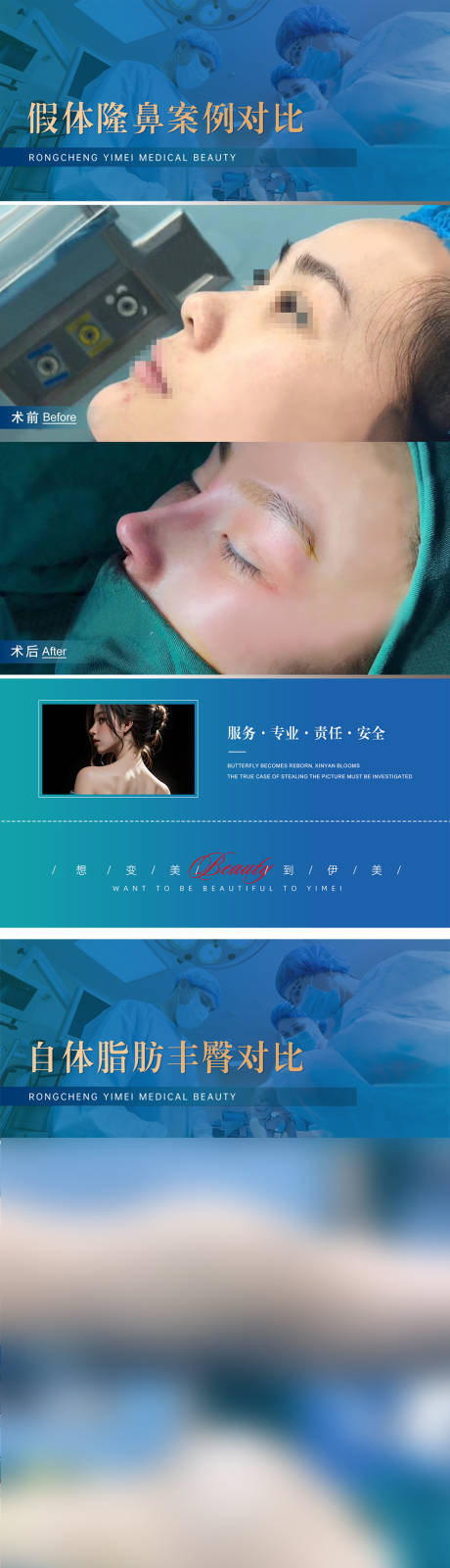 源文件下载【医美整形案例对比模版】编号：42830019610631140