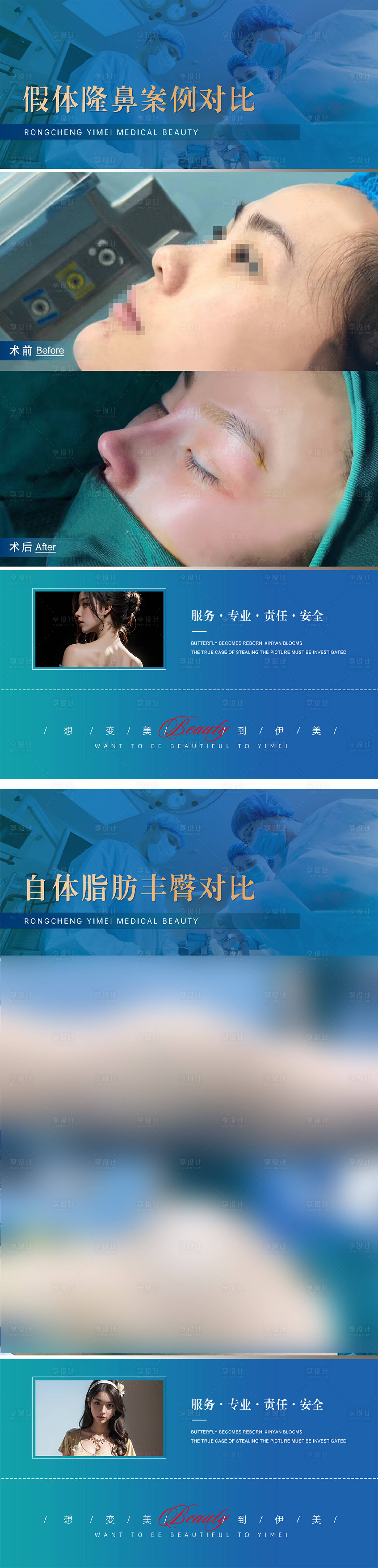 源文件下載【享設(shè)計(jì)】搜索編號(hào)：42830019610631140【醫(yī)美整形案例對(duì)比模版】
