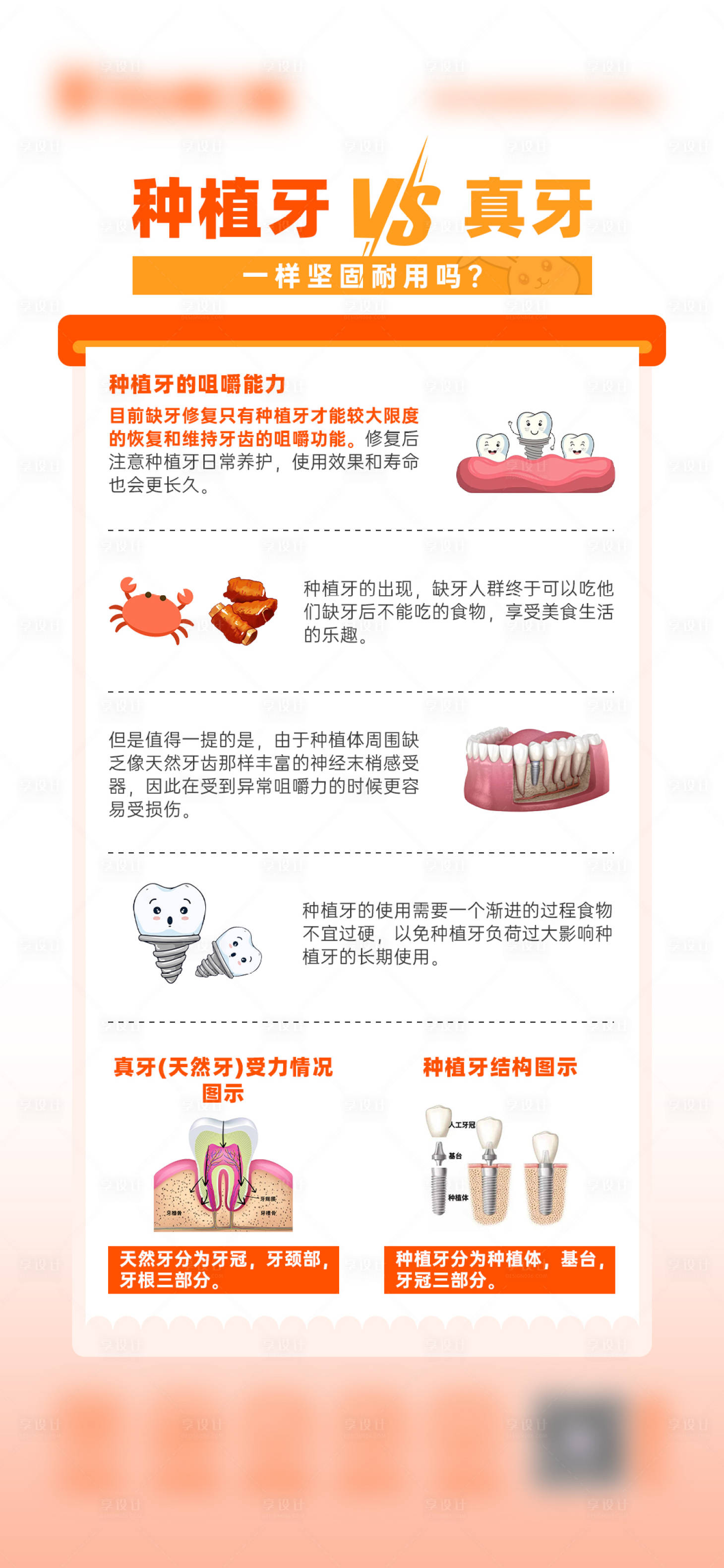 源文件下载【享设计】搜索编号：96950027534759585【种植牙VS真牙】