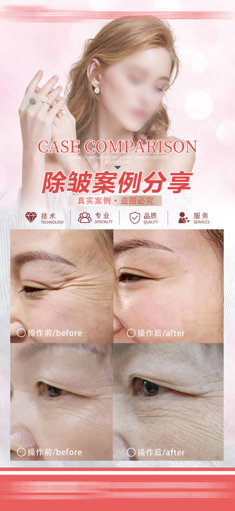 源文件下載【享設計】搜索編號：67120027441654158【除皺案例分享海報】