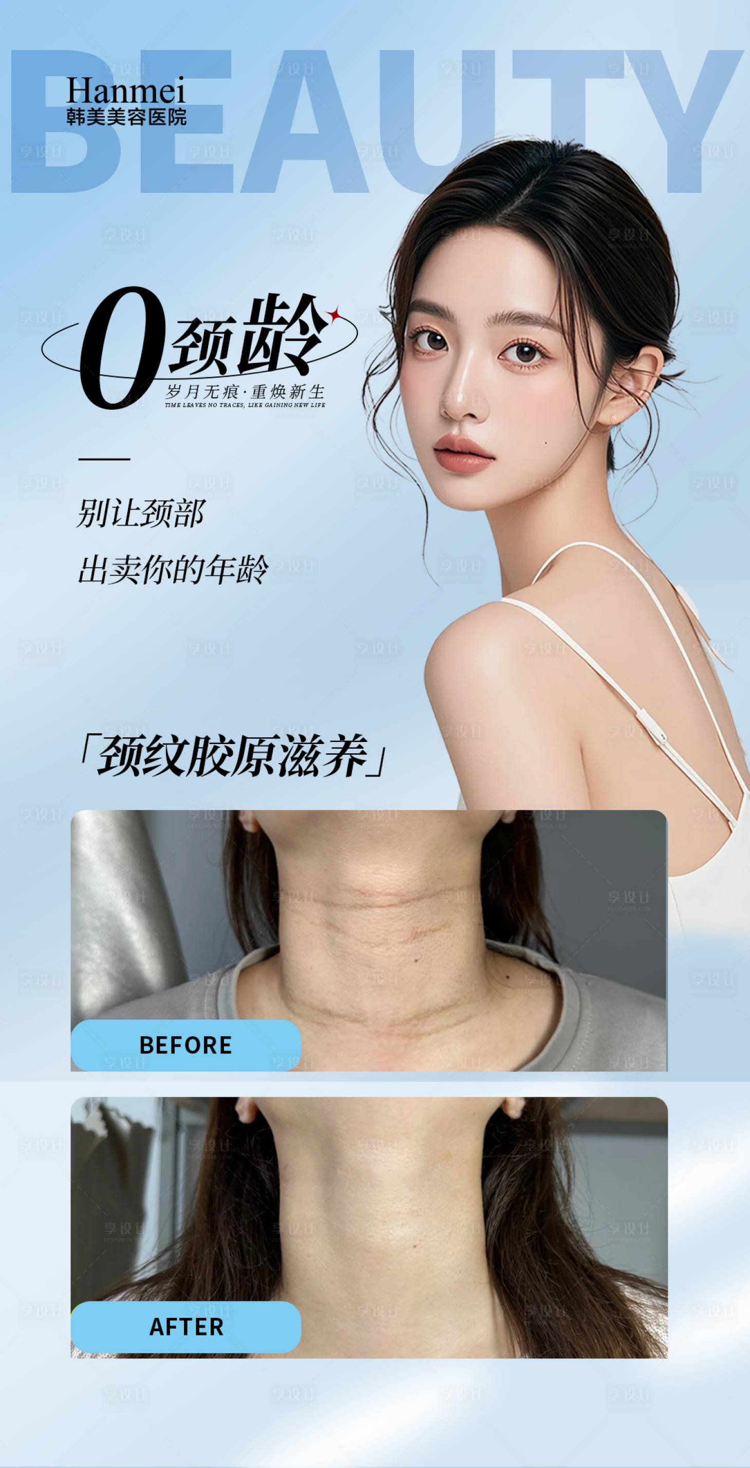 源文件下載【享設計】搜索編號：58120027306601403【祛頸紋案例】