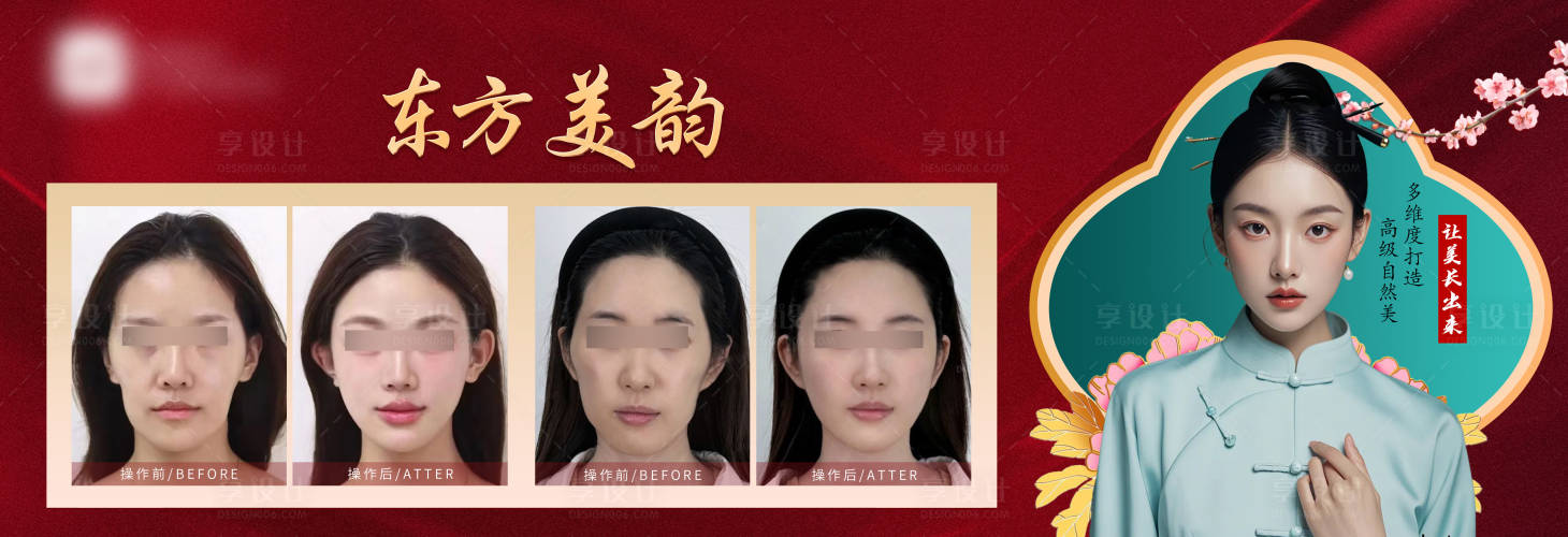 源文件下载【享设计】搜索编号：17180027109219988【医美东方美韵对比案例海报展板】