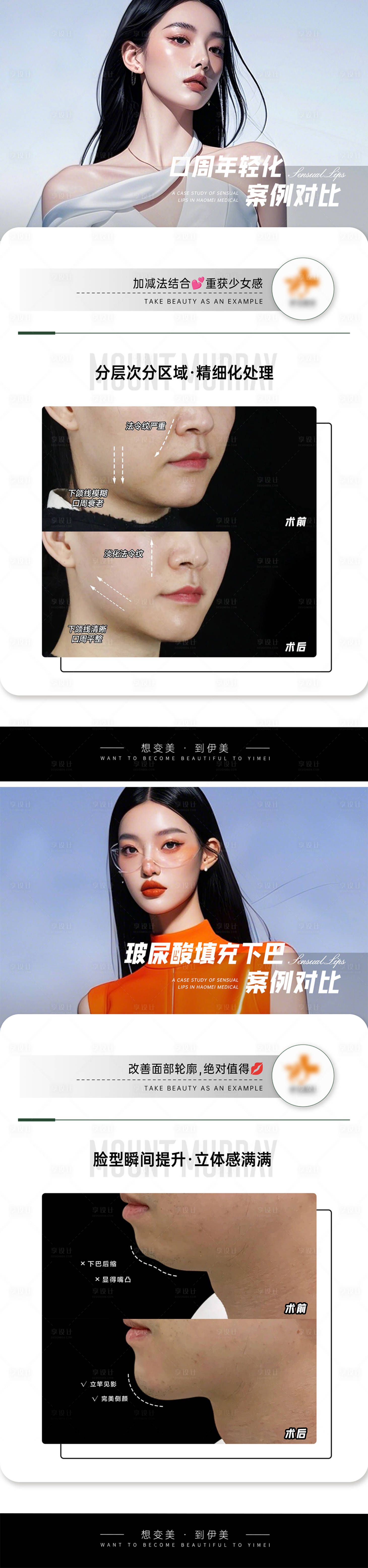 源文件下載【享設計】搜索編號：81010027245942463【醫美案例對比模板】