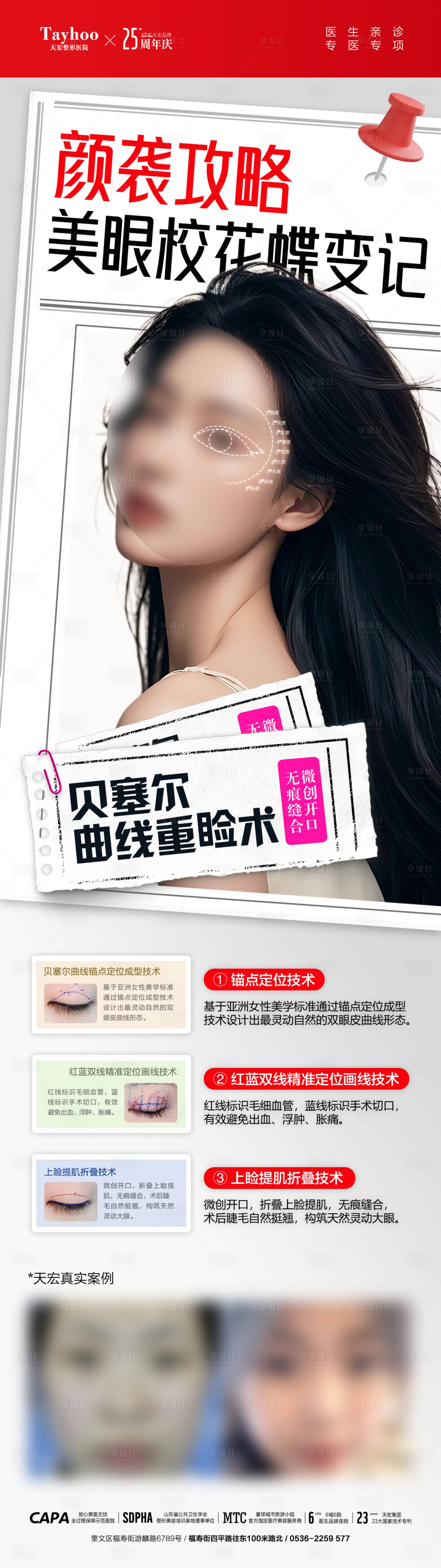 源文件下載【享設計】搜索編號：49150027232185839【眼整形案例海報】