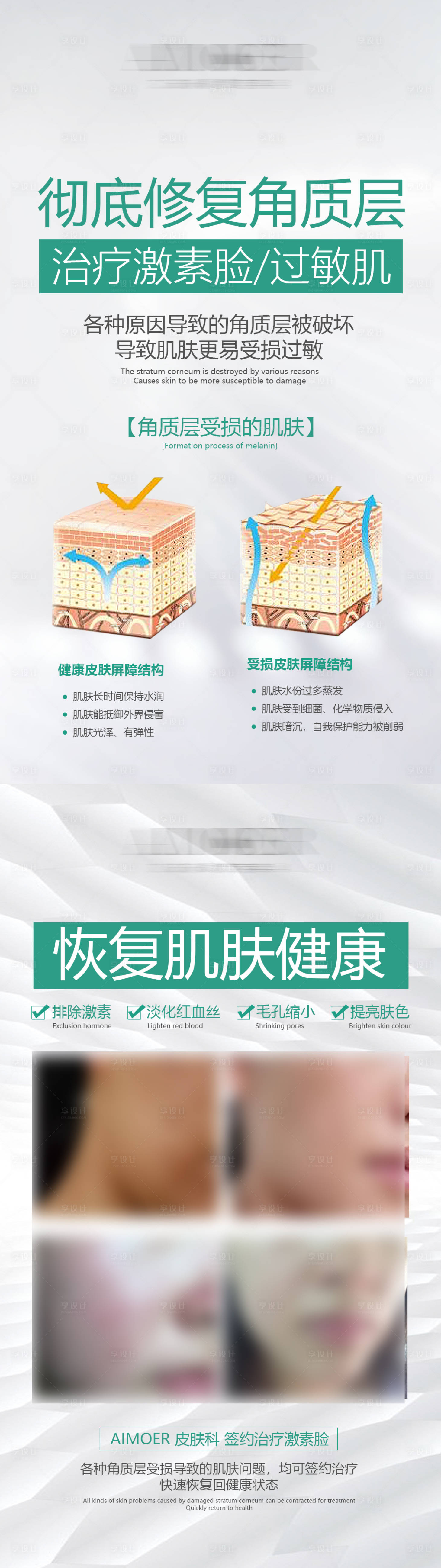 源文件下載【享設(shè)計】搜索編號：25180027135581305【醫(yī)美問題肌科普案例海報】
