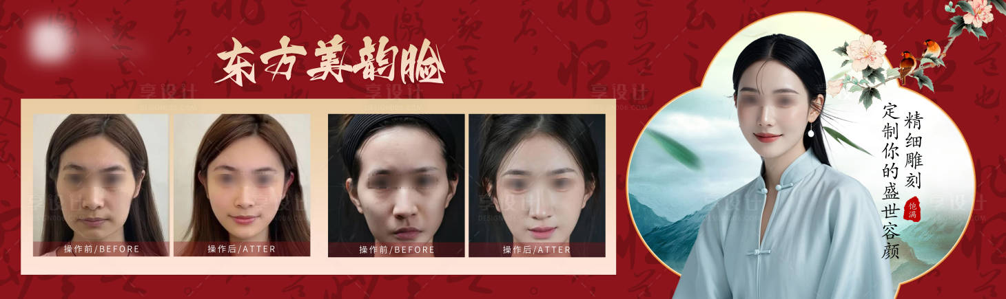 源文件下载【享设计】搜索编号：53000027095978206【医美国泰民安脸对比上墙海报】