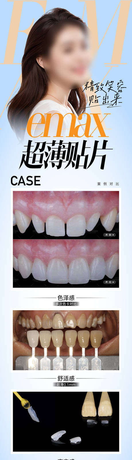源文件下載【享設計】搜索編號：32430027457838185【口腔貼片海報長圖】