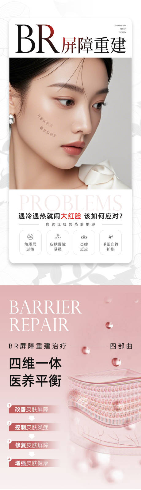 源文件下載【享設(shè)計】搜索編號：38280027308056831【BR屏障重建】