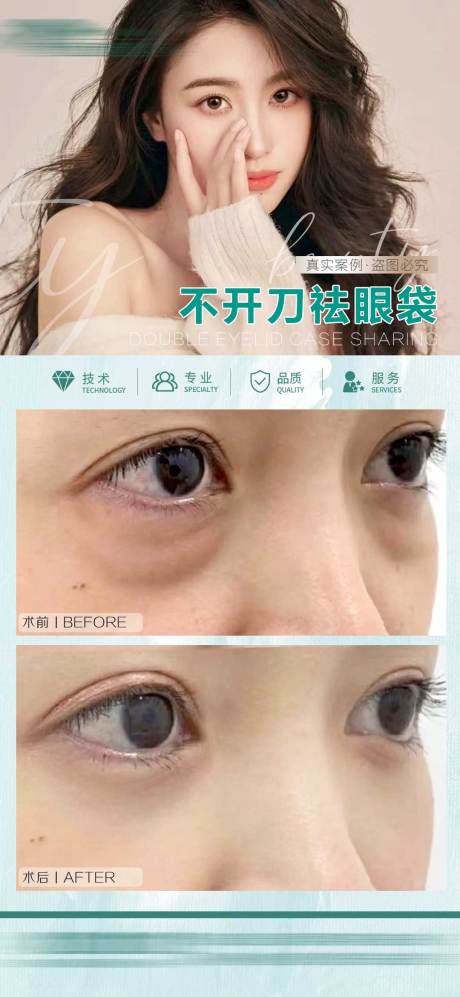 源文件下载【祛眼袋】编号：63290027423377012