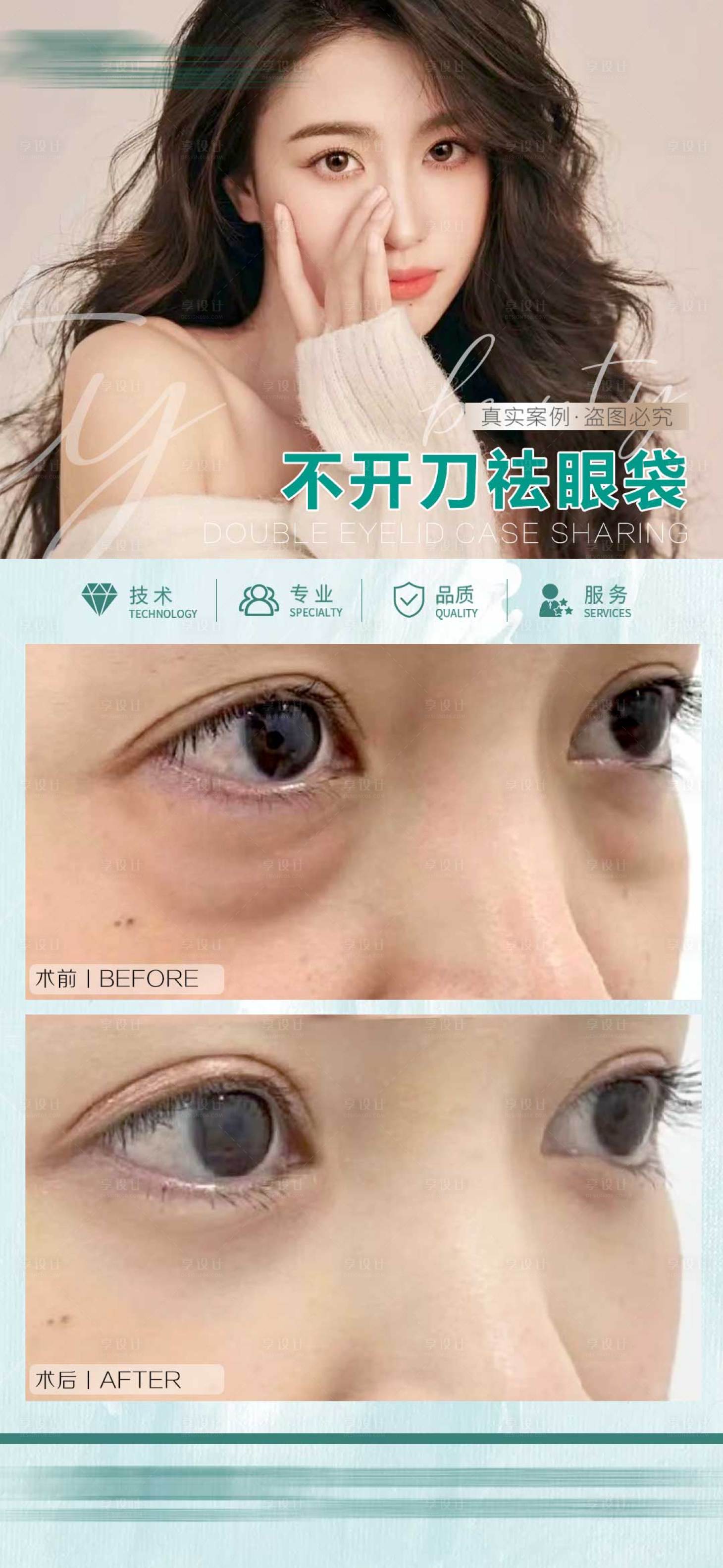 源文件下載【祛眼袋】編號：63290027423377012