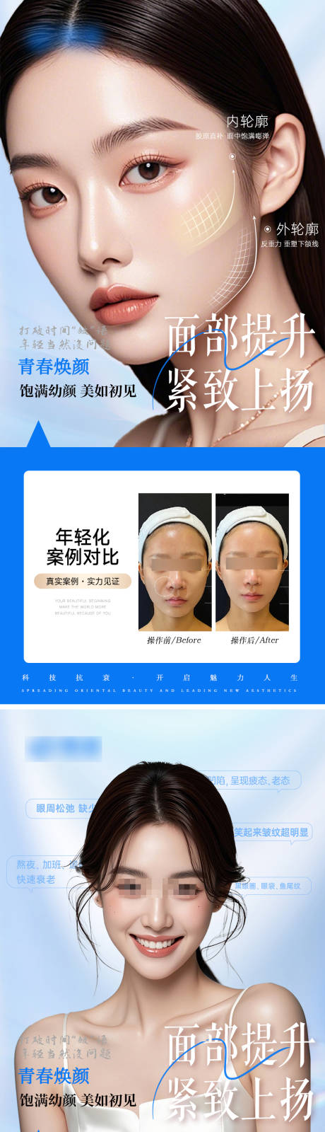 源文件下载【医美轮廓抗衰案例对比宣传海报】编号：73370027249362186