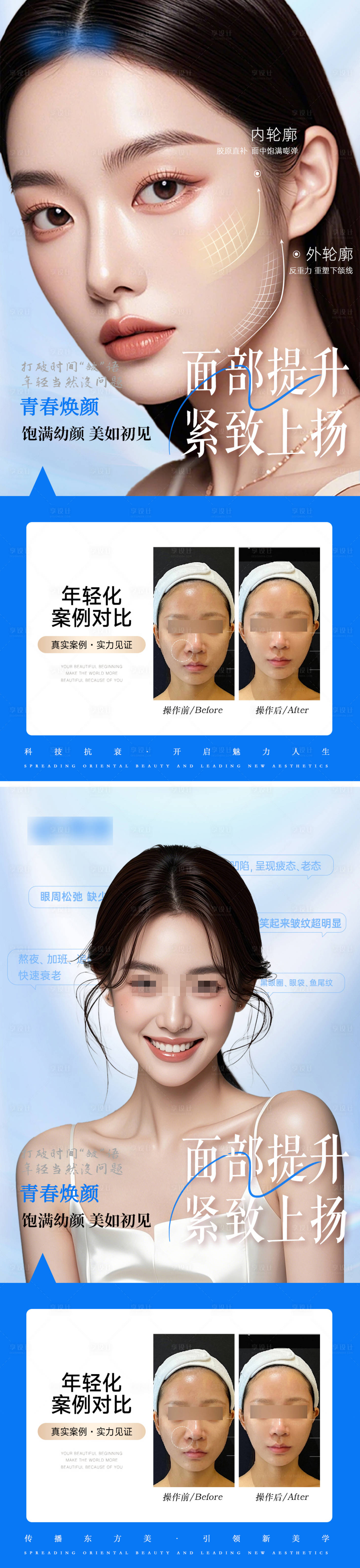 源文件下载【享设计】搜索编号：73370027249362186【医美轮廓抗衰案例对比宣传海报】