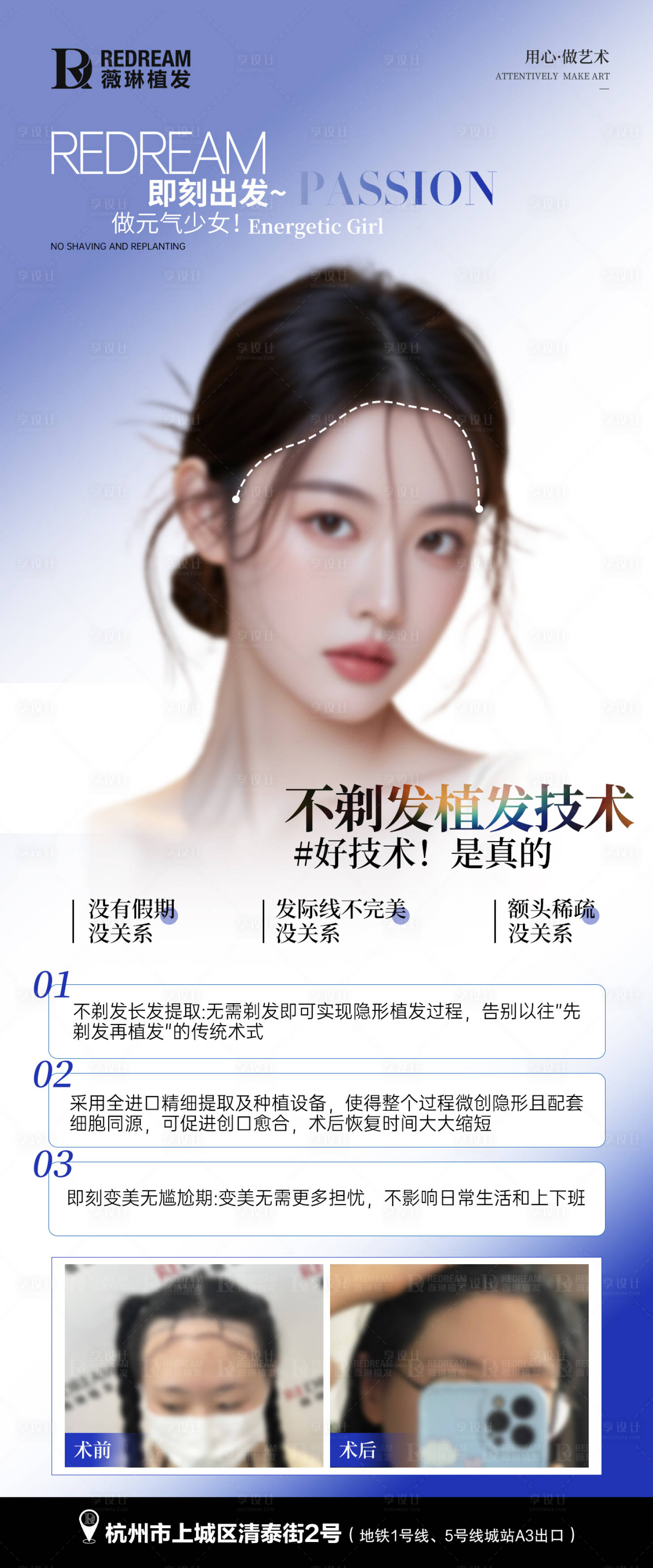 源文件下載【享設計】搜索編號：55890027180979700【植發海報】