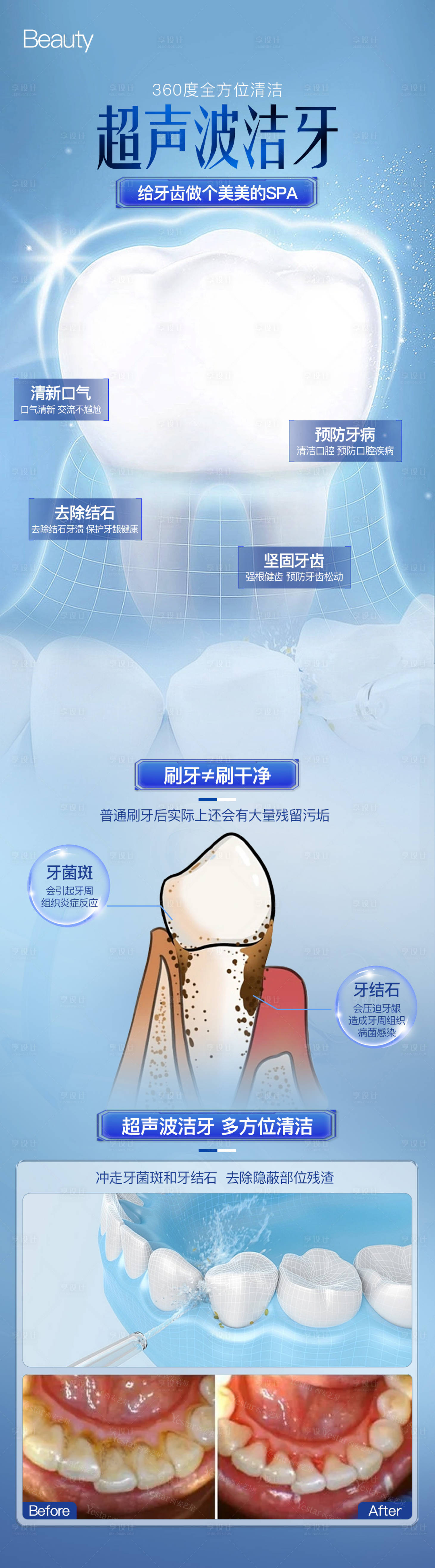 源文件下载【享设计】搜索编号：62550027211663117【口腔超声波洁牙海报】