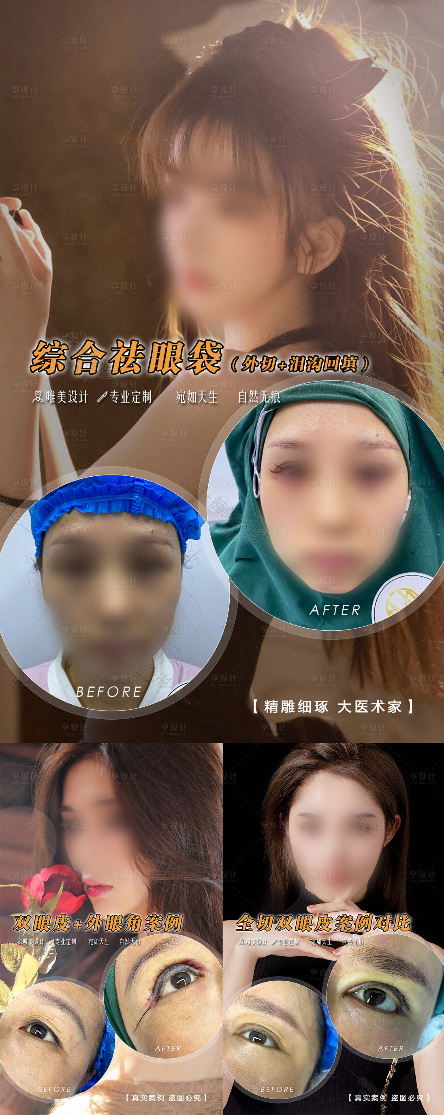 源文件下載【享設計】搜索編號：24570027225481040【醫美案例對比系列海報】
