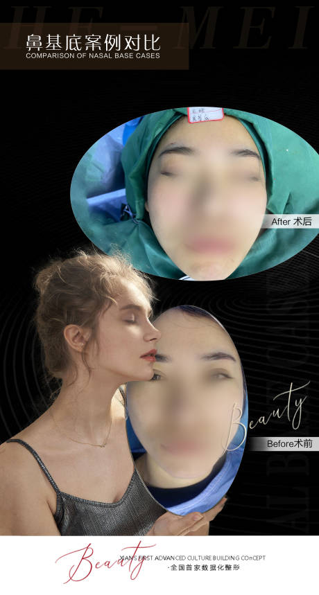 医美案例对比