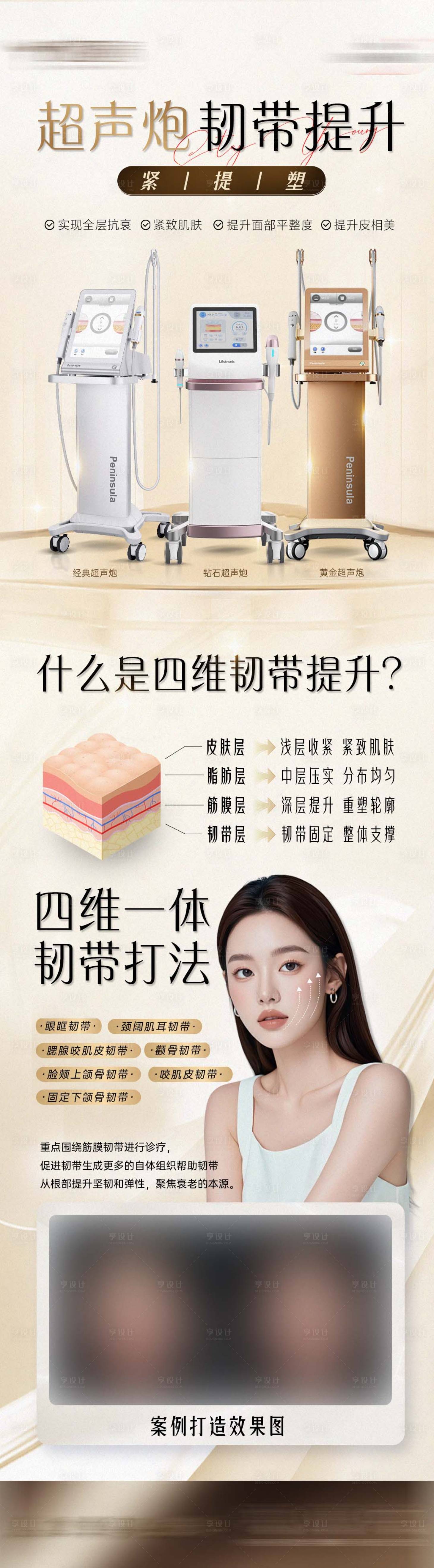 源文件下载【超声炮韧带提升】编号：92810027222835597