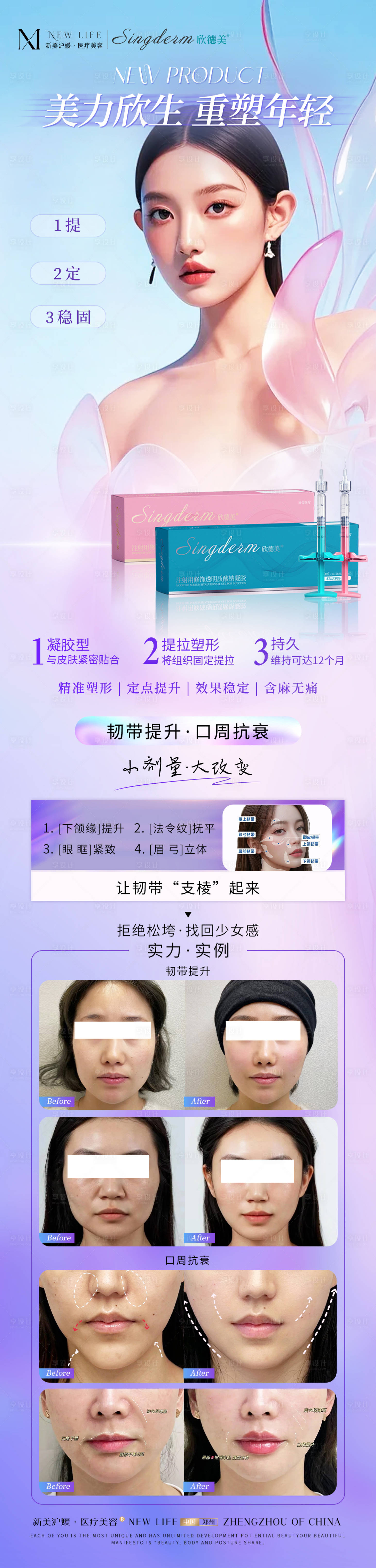 源文件下载【医美抗衰韧带提升案例海报】编号：76060027417585404