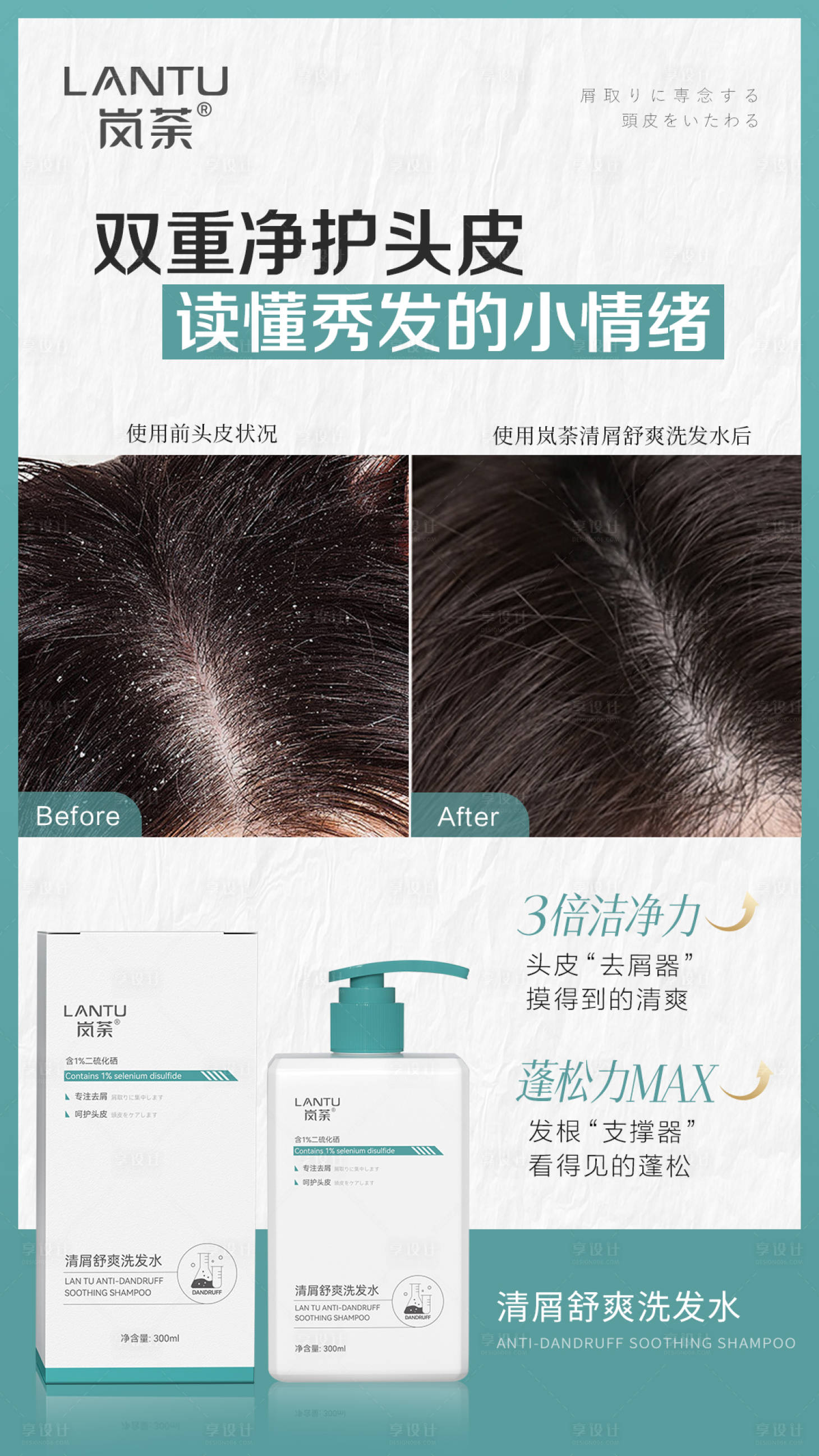 源文件下载【去屑洗发水头皮对比海报】编号：93190027586386375
