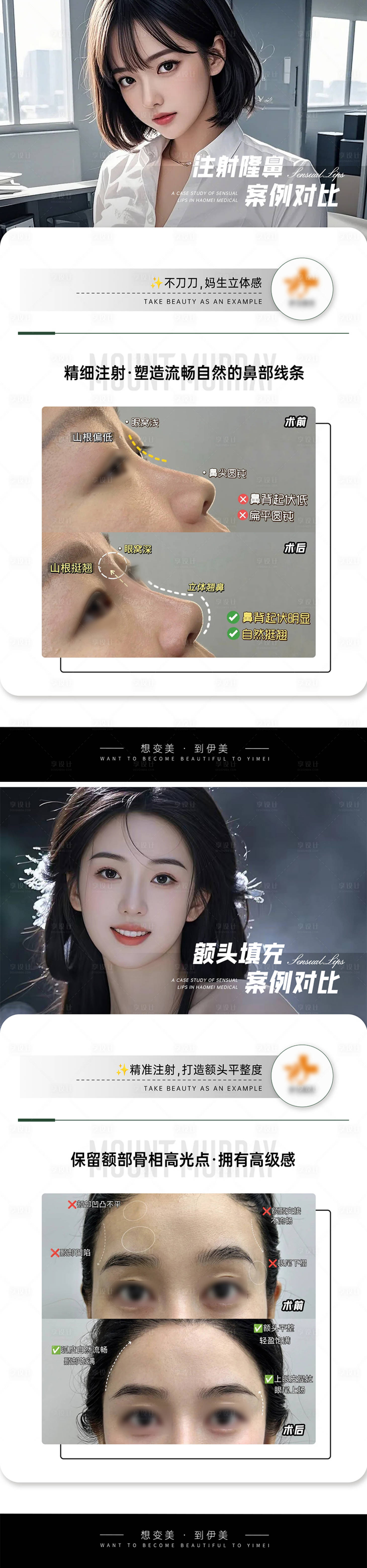 源文件下载【医美案例对比模板】编号：41510027387284052