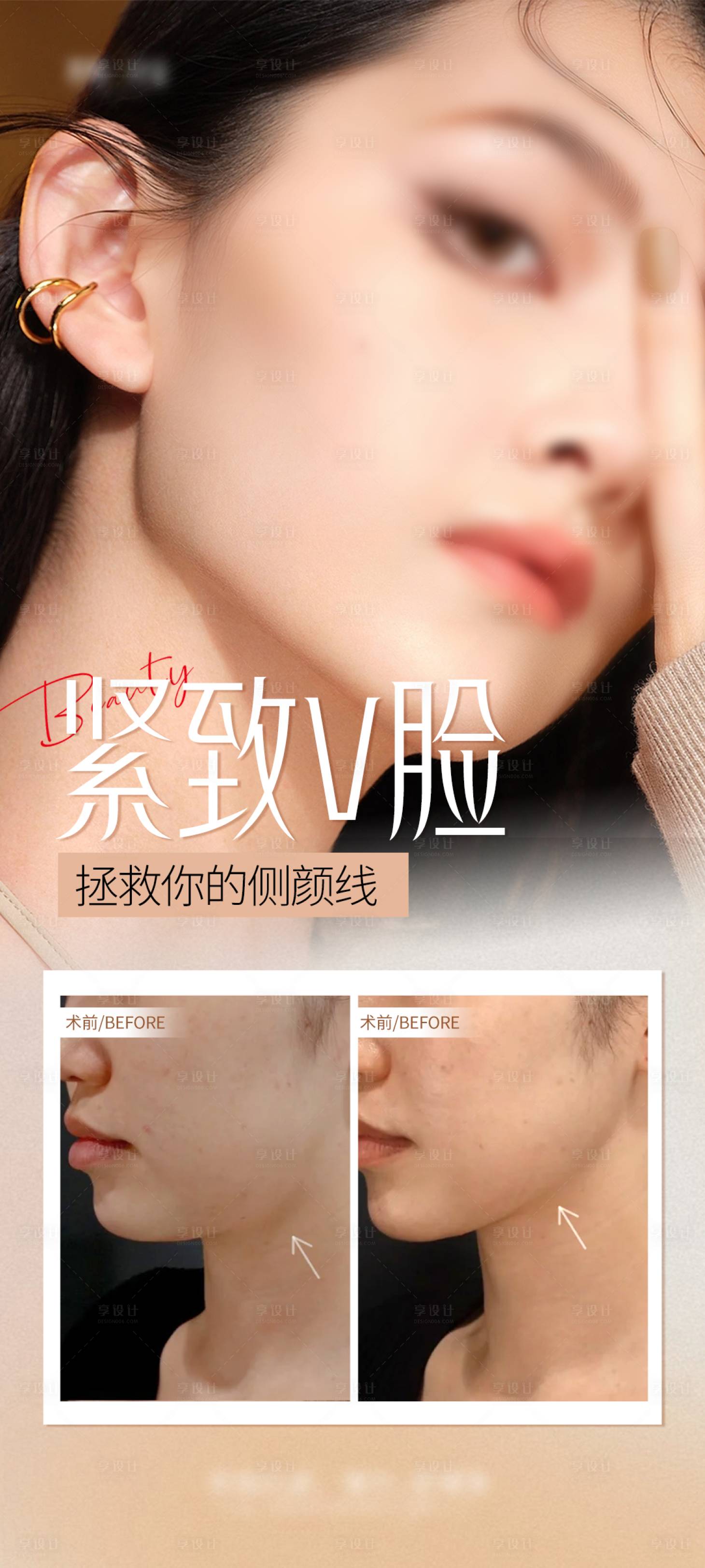 源文件下载【享设计】搜索编号：42890027476971757【紧致V脸海报】