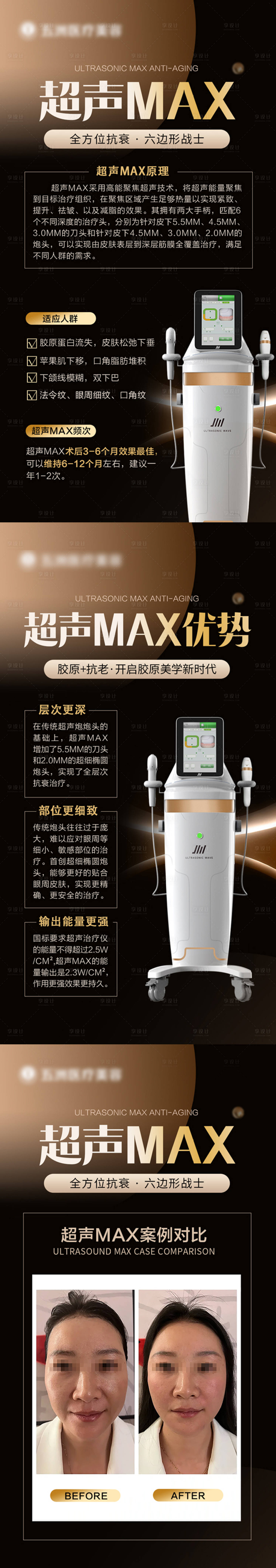 源文件下载【医美超声MAX仪器系列海报】编号：23710027433083415