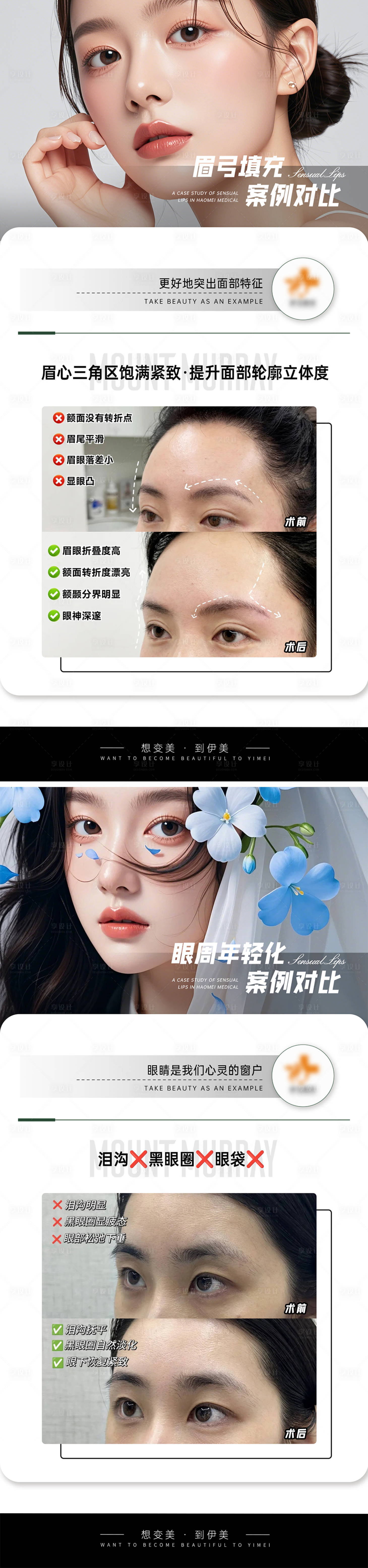 源文件下載【享設計】搜索編號：82170027270319695【醫美案例對比模板】
