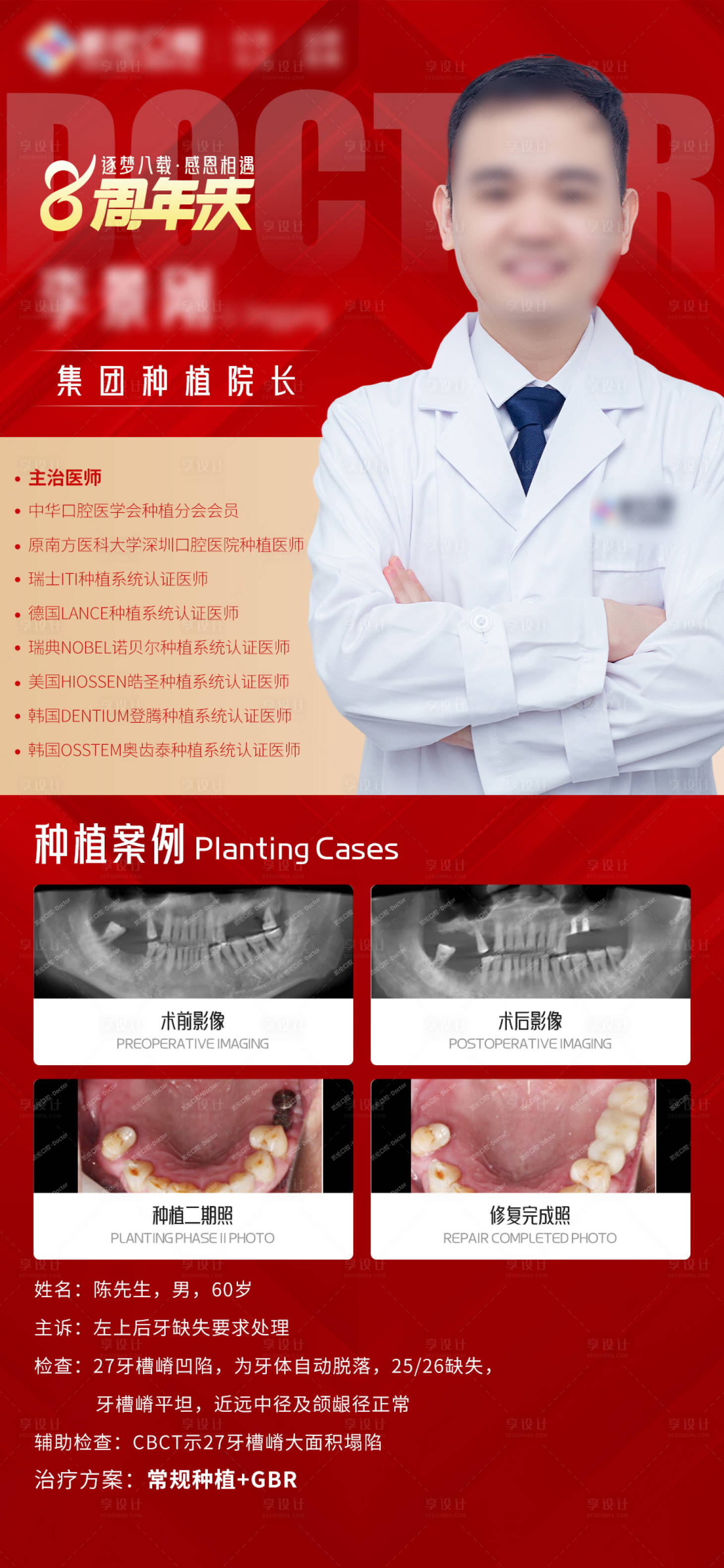 源文件下载【享设计】搜索编号：74060027283275835【周年庆种植牙案例】