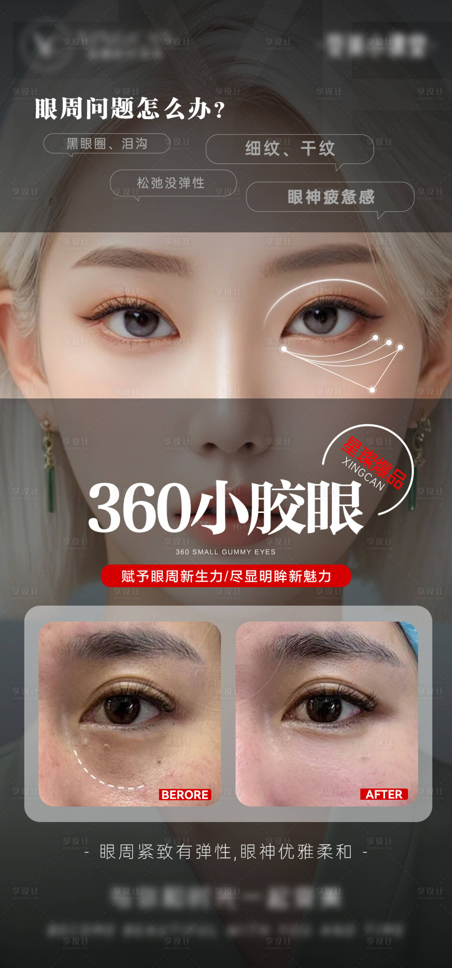 源文件下載【享設計】搜索編號：58640027400377281【醫美眼部問題海報】
