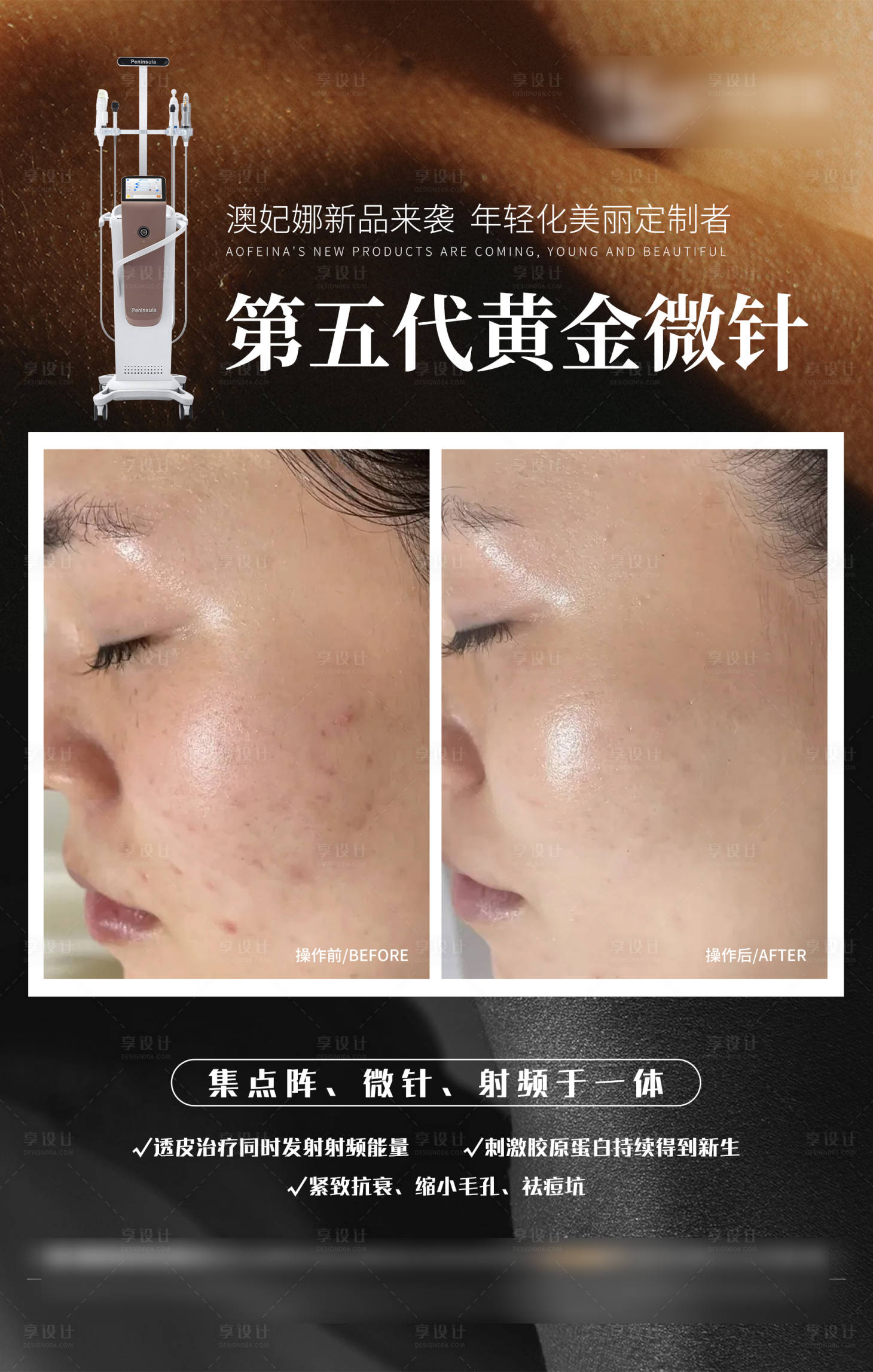 源文件下载【医美皮肤案例对比海报】编号：11320027197043837
