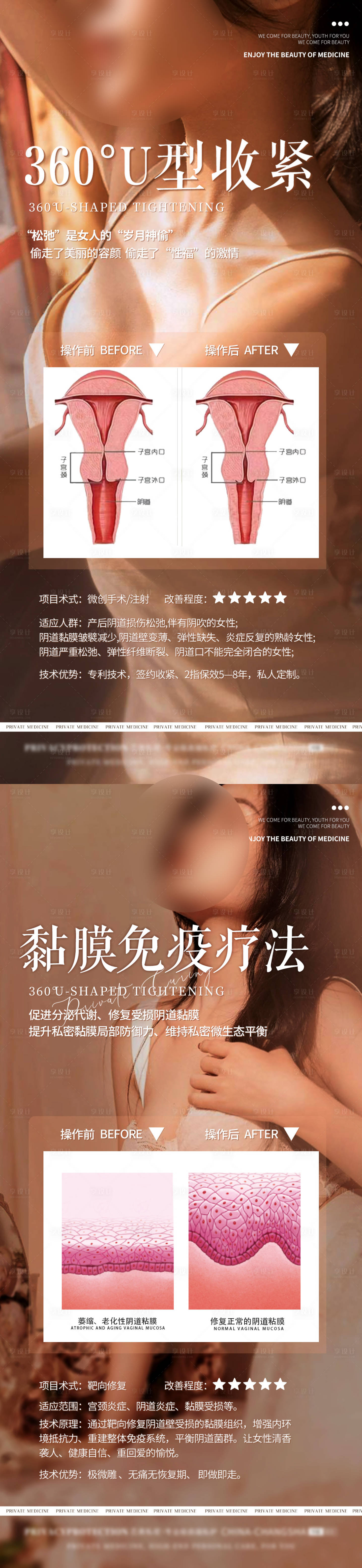 源文件下载【医美私密项目海报 】编号：77130027067118733