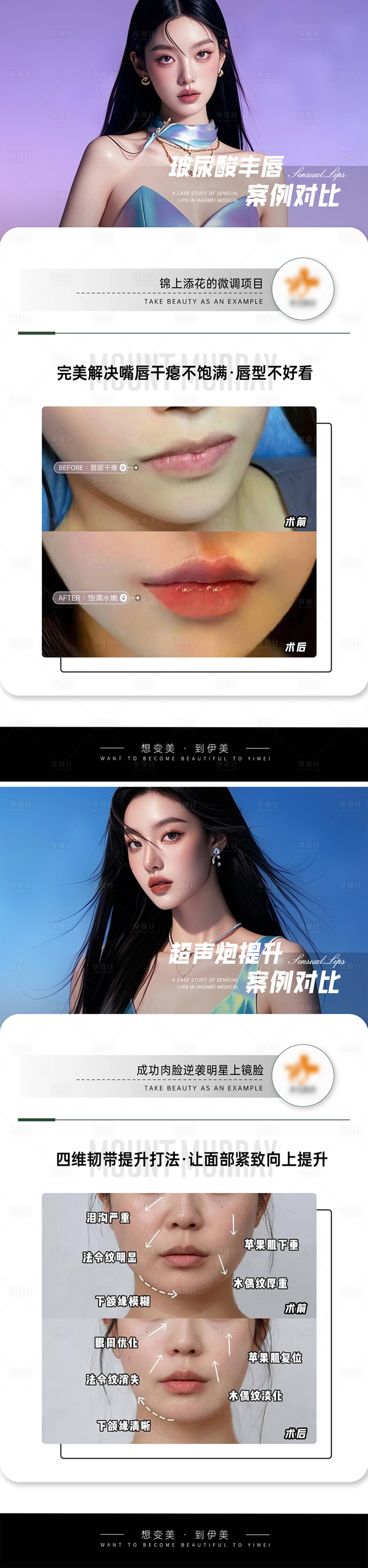 源文件下载【享设计】搜索编号：89060027206526932【医美案例对比系列海报】