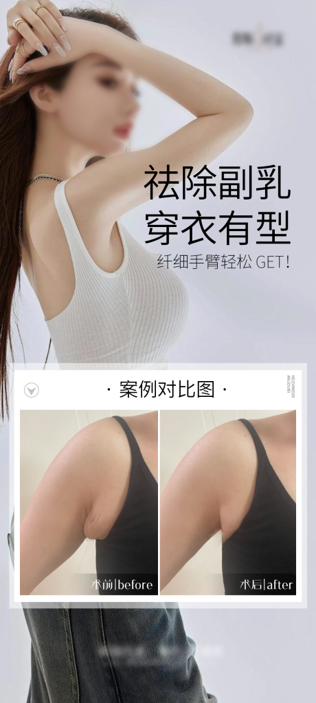 源文件下载【副乳祛除海报】编号：93980027606495294