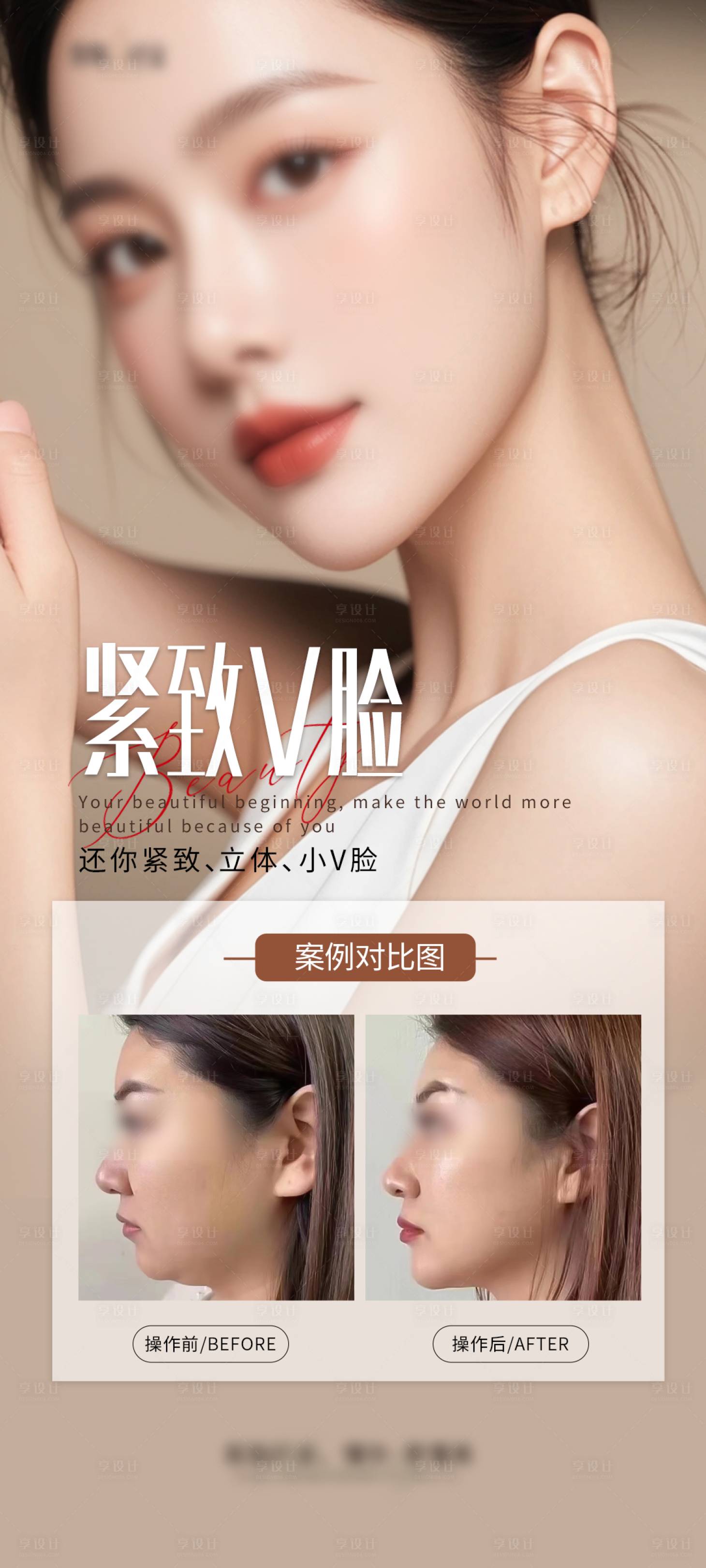 源文件下载【享设计】搜索编号：70680028018219942【医美v脸海报】