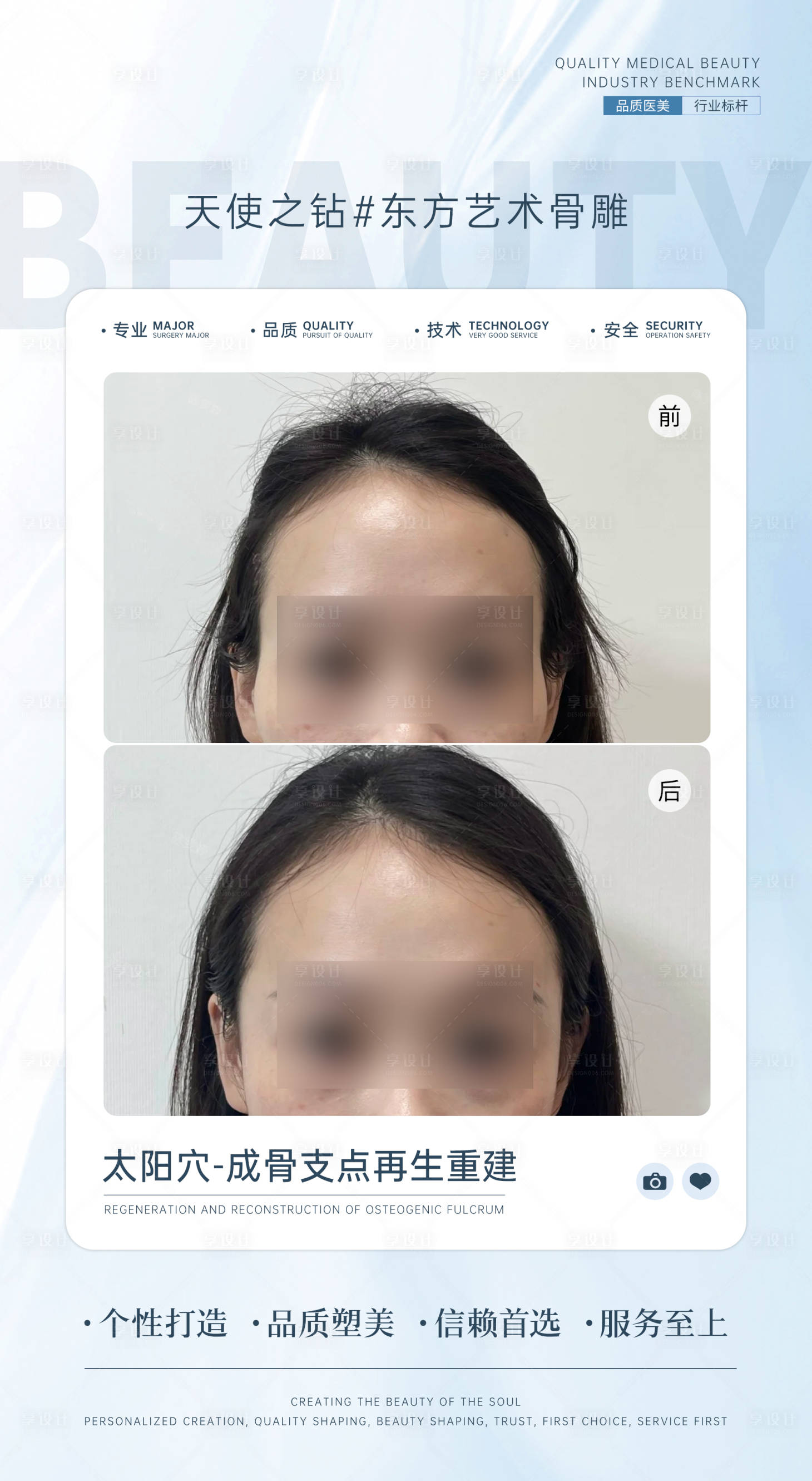 源文件下載【享設計】搜索編號：83050027671528977【太陽穴案例對比海報】