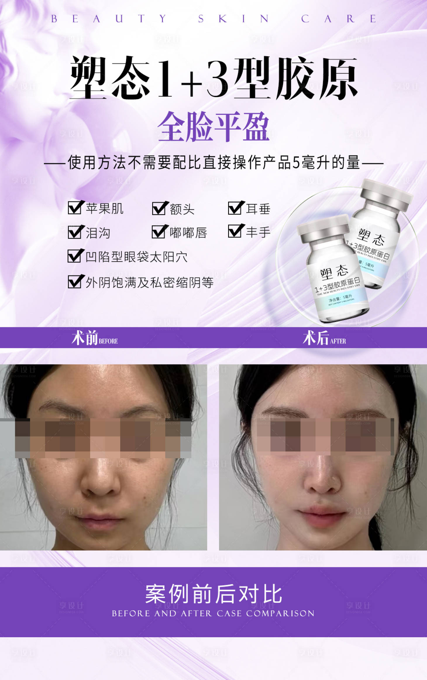 源文件下載【享設(shè)計】搜索編號：58270028104545314【醫(yī)美抗衰對比海報】