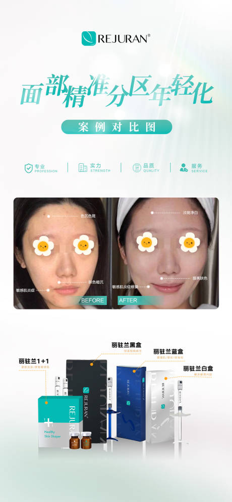 面部分区对比海报