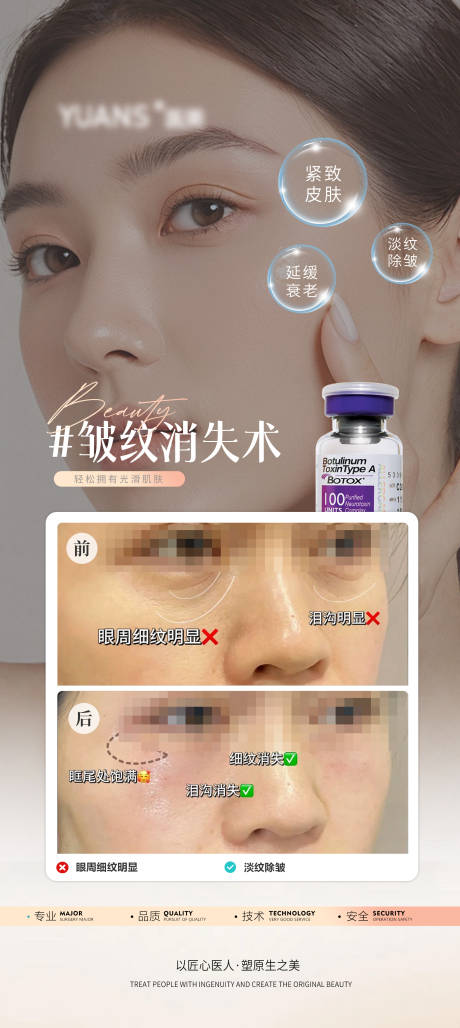 源文件下载【医美除皱案例对比图】编号：93240027758807711