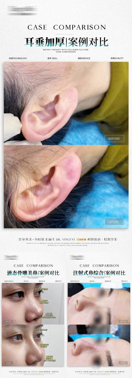 源文件下载【享设计】搜索编号：48190027681221766【微整案例对比】