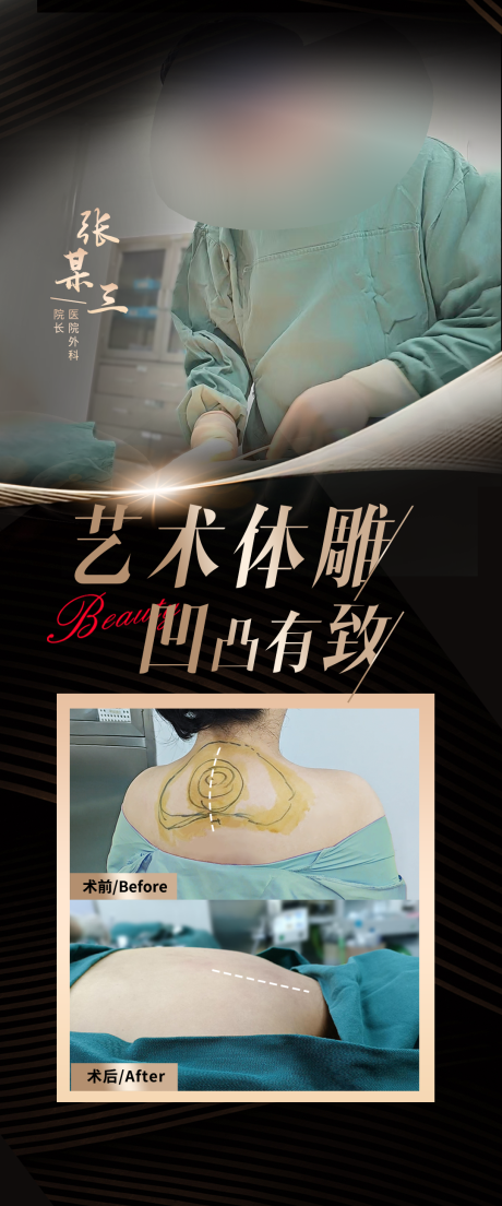 富贵包吸脂