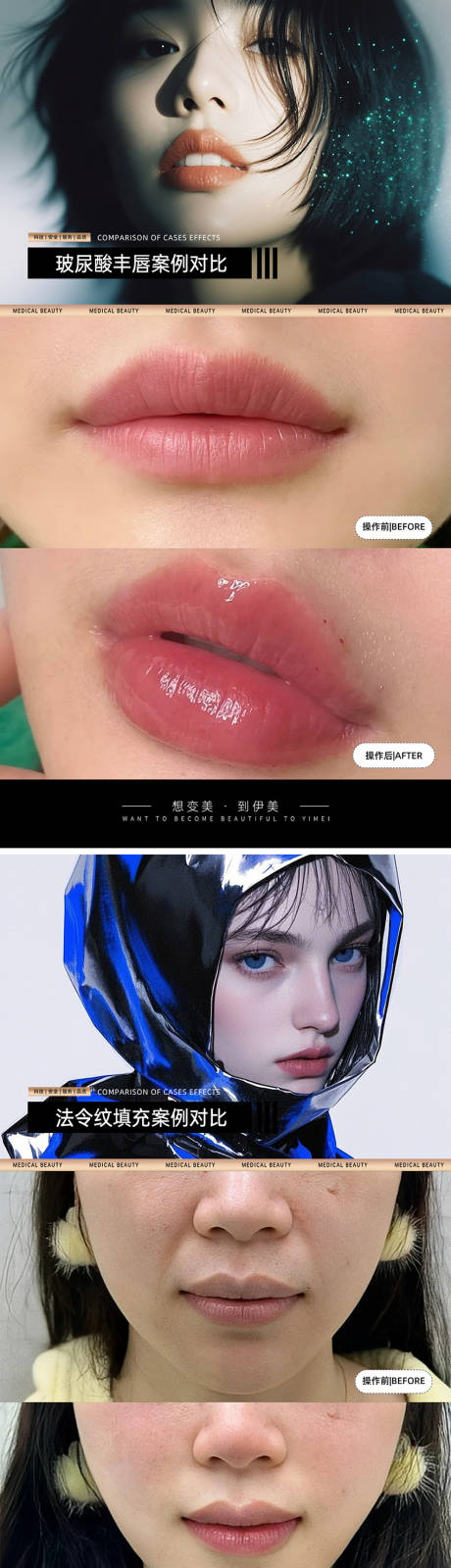 源文件下載【享設計】搜索編號：63520027858662052【醫美案例對比海報】