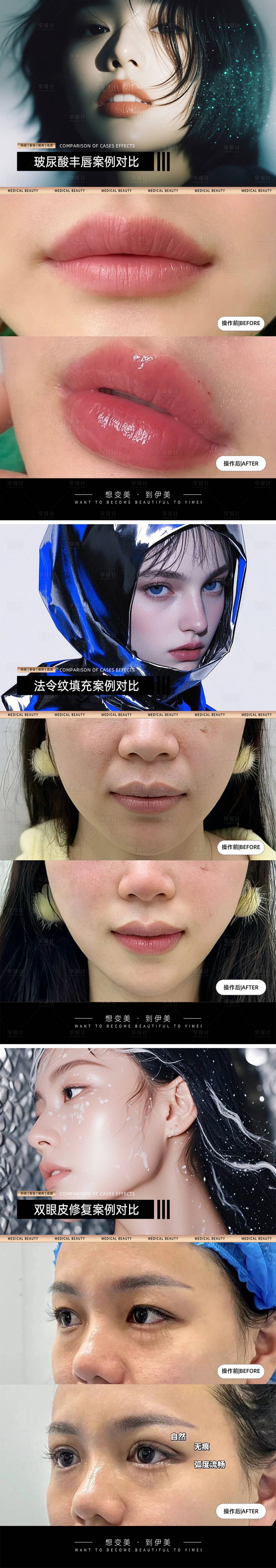 源文件下載【享設(shè)計】搜索編號：63520027858662052【醫(yī)美案例對比海報】
