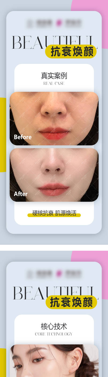 源文件下載【享設(shè)計(jì)】搜索編號(hào)：27380027997607803【醫(yī)美案例科普海報(bào)】