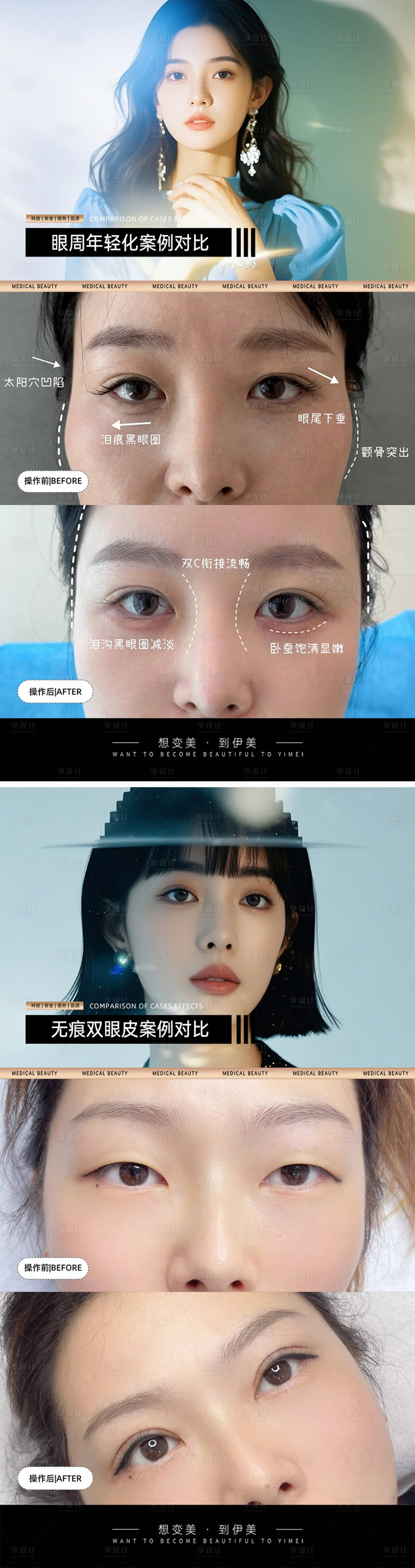源文件下载【享设计】搜索编号：88100027824247002【医美案例对比模板】