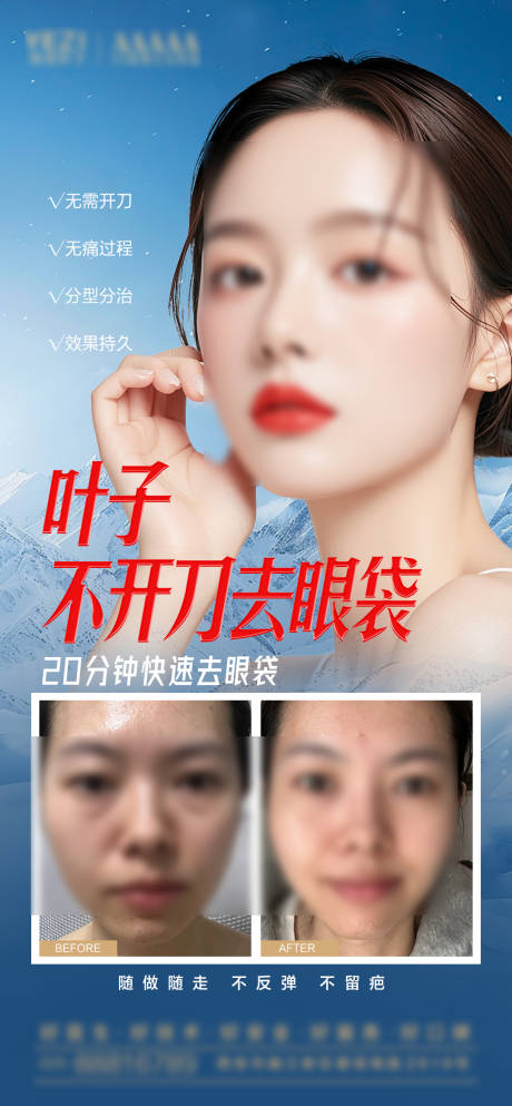 源文件下载【祛眼袋案例海报】编号：88870027848031336